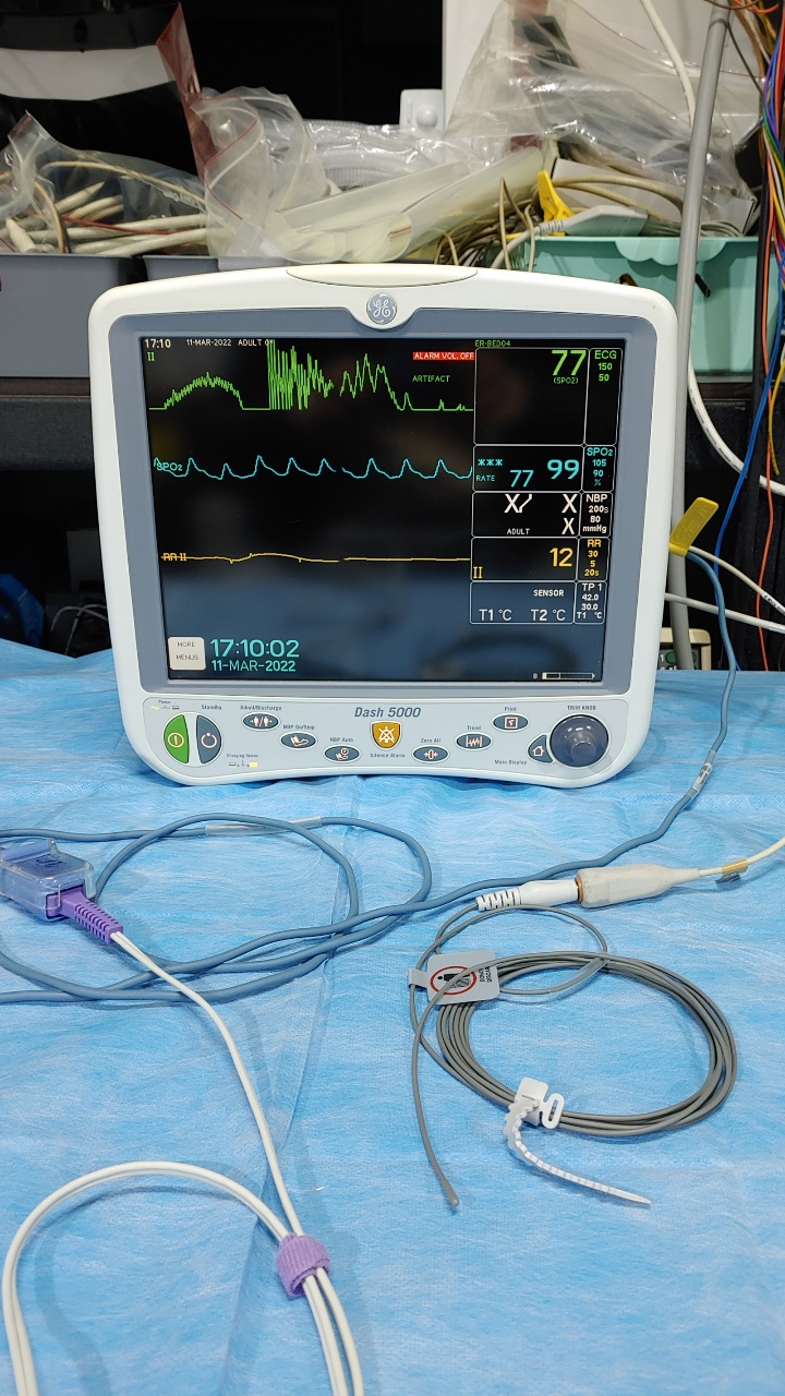 GE Dash 5000 Patient Monitor