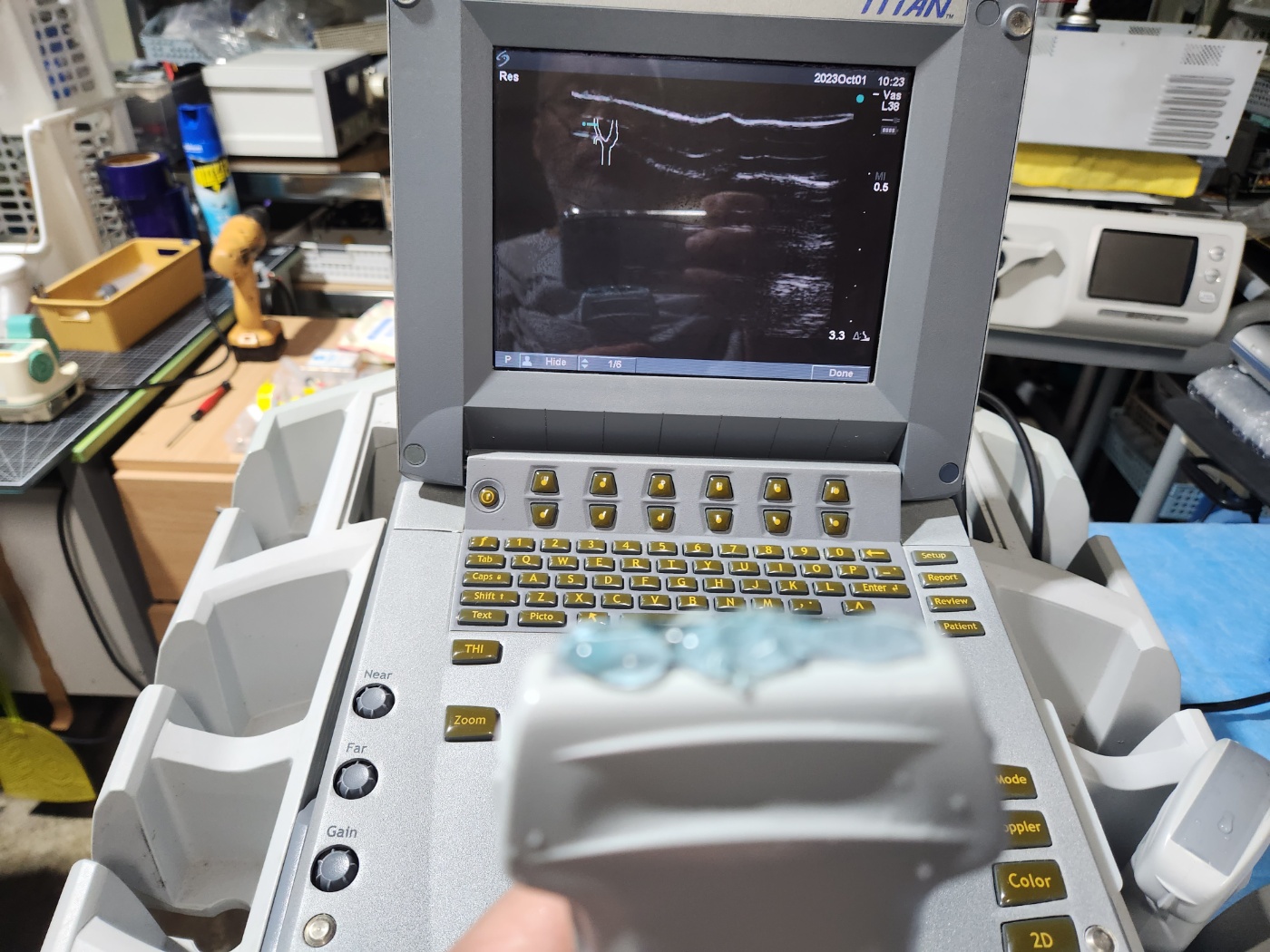 SonoSite Titan ultrasound machine