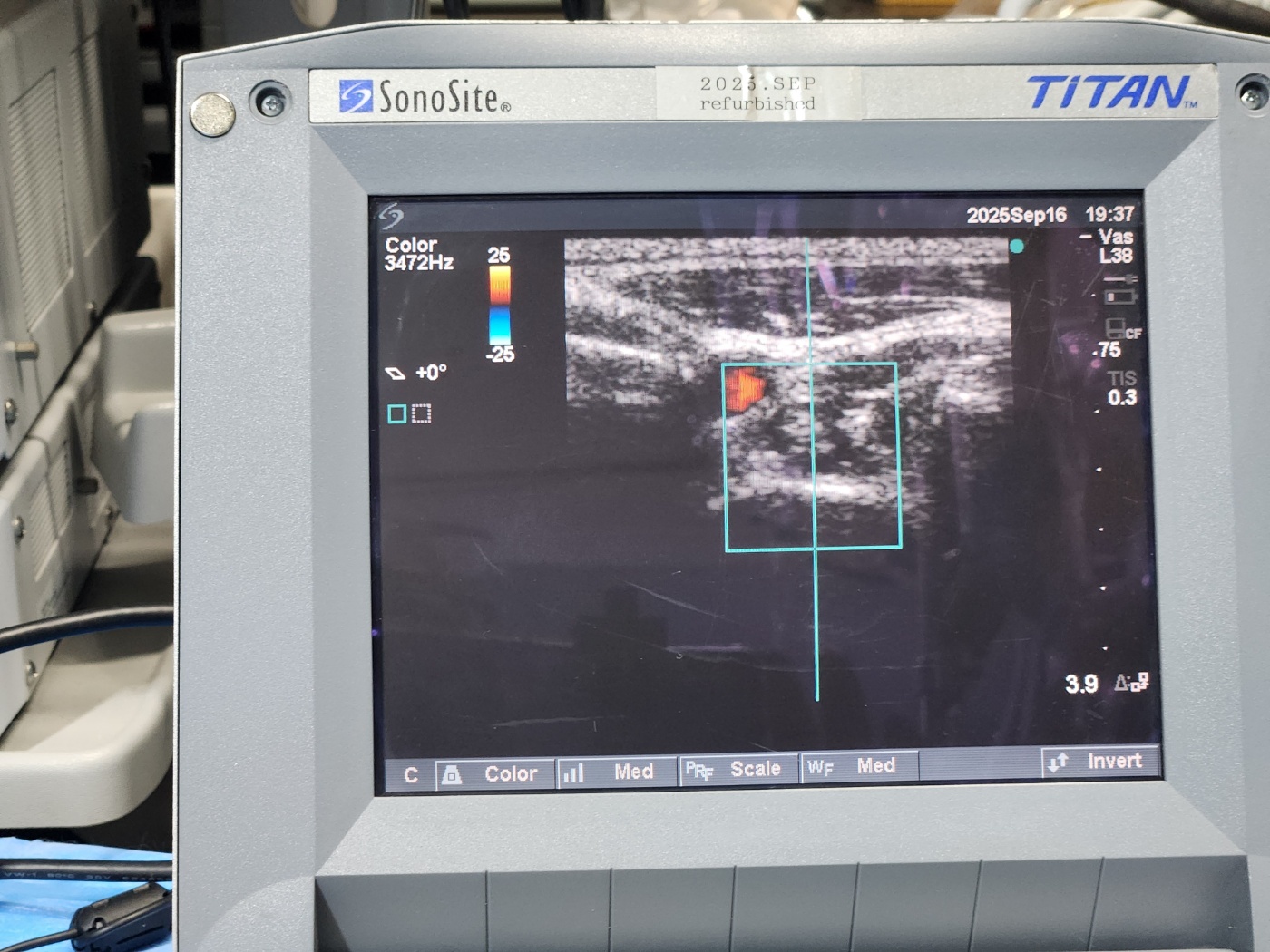 SonoSite Titan ultrasound machine