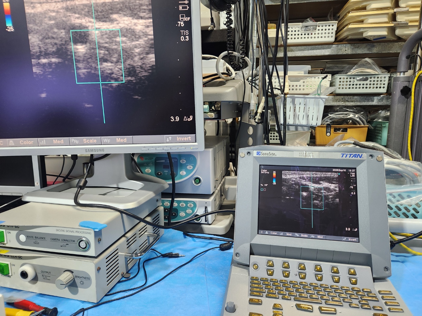 SonoSite Titan ultrasound machine