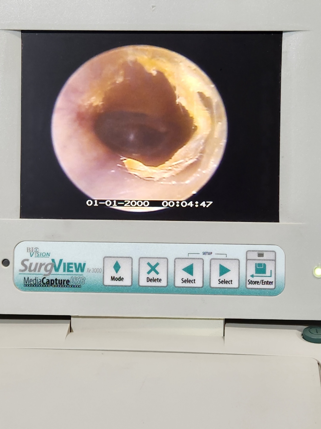 Biovision Veterinary Endoscopy system