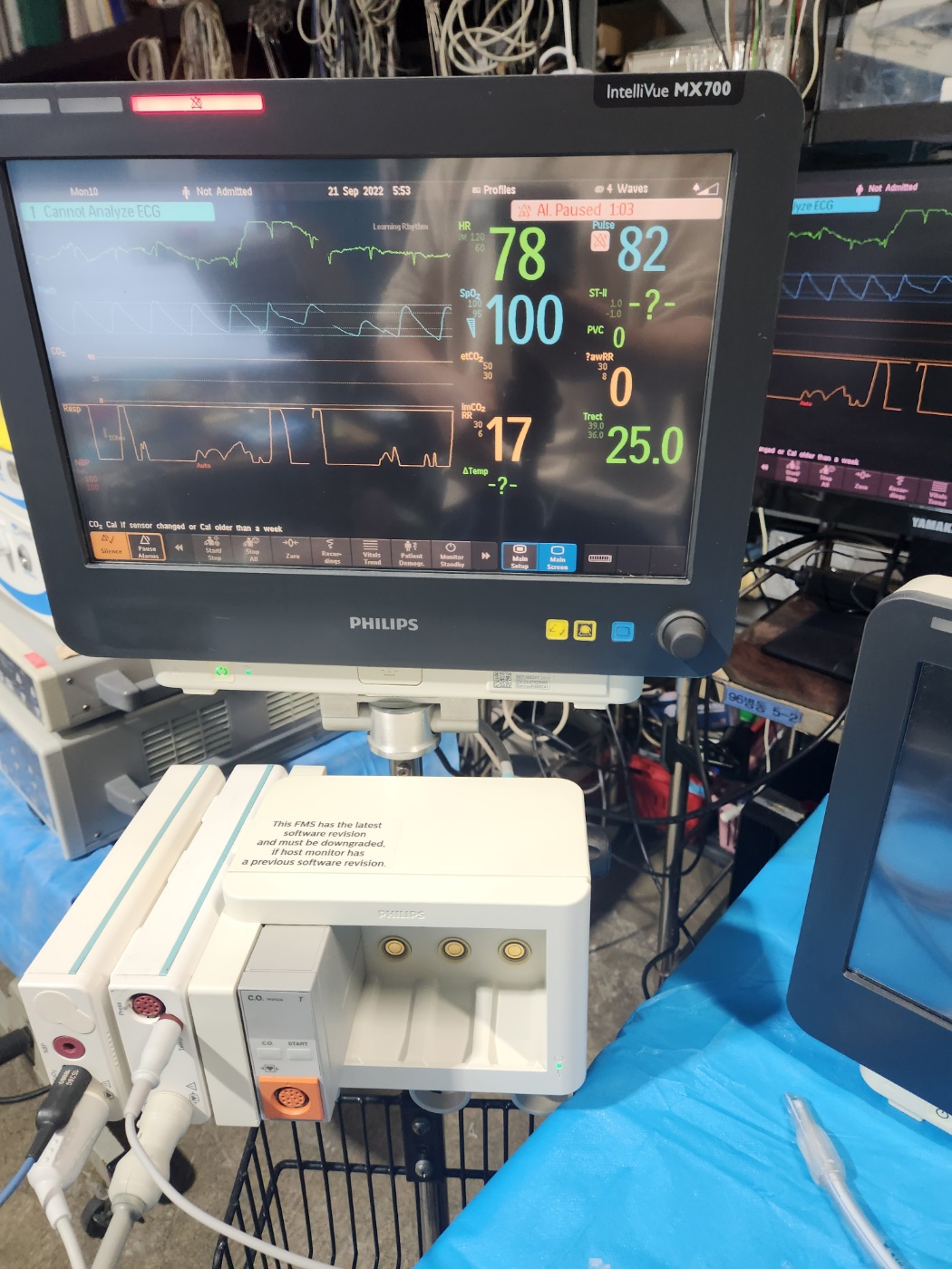 Philips IntelliVue MX700 Patient Monitor