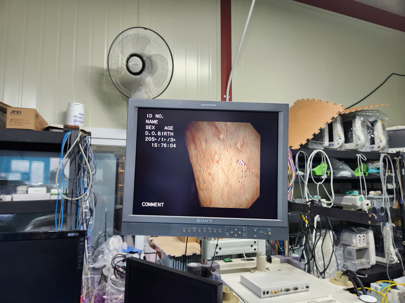 Olympus URF-V Flexible Video Ureteroscope Sterrad