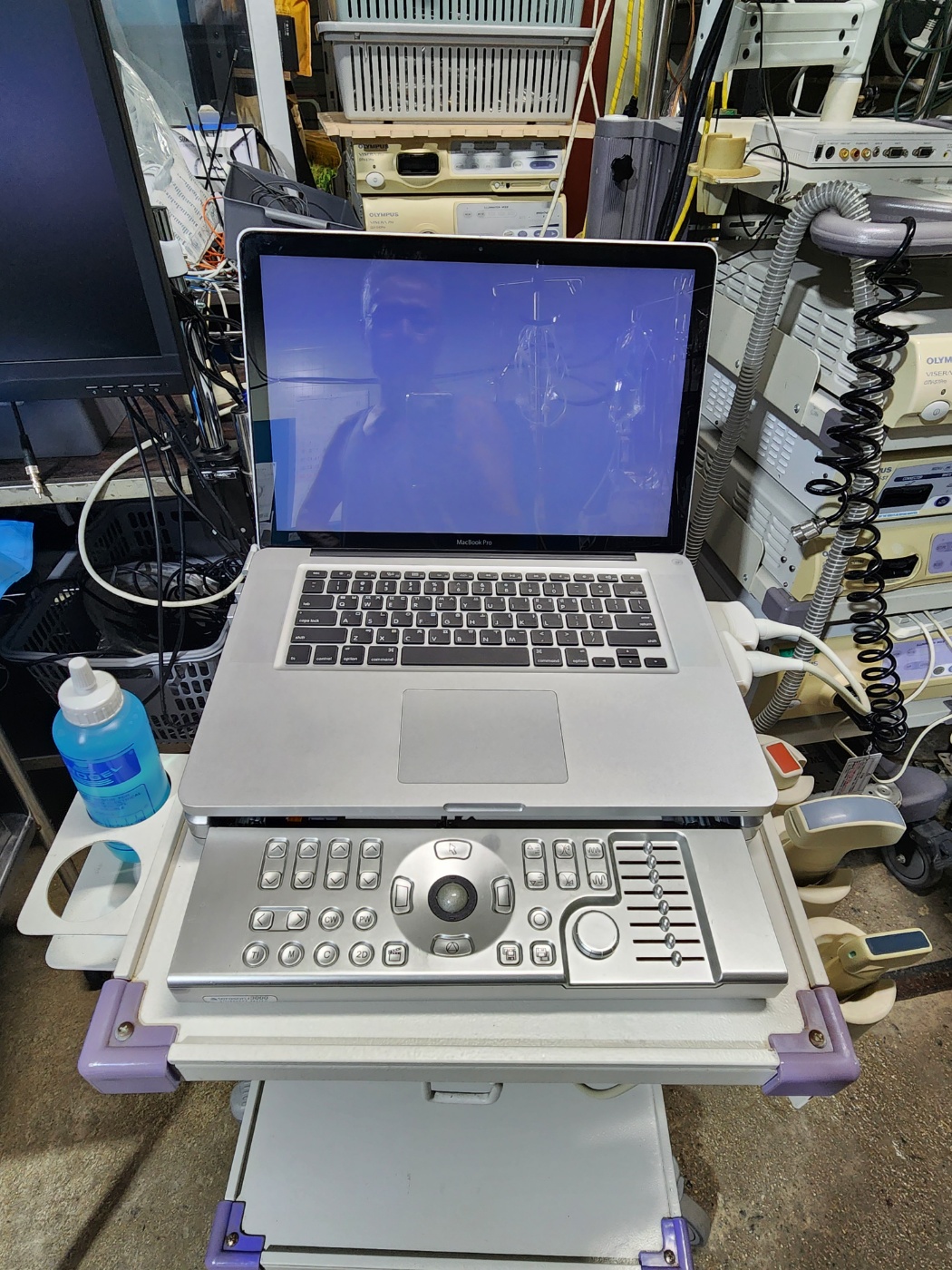 Terason t 3000cv  ™ Ultrasound System