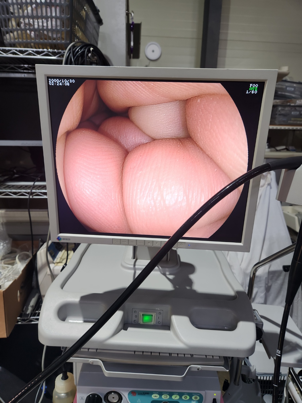 Fujinon EG-590WR Gastroscope