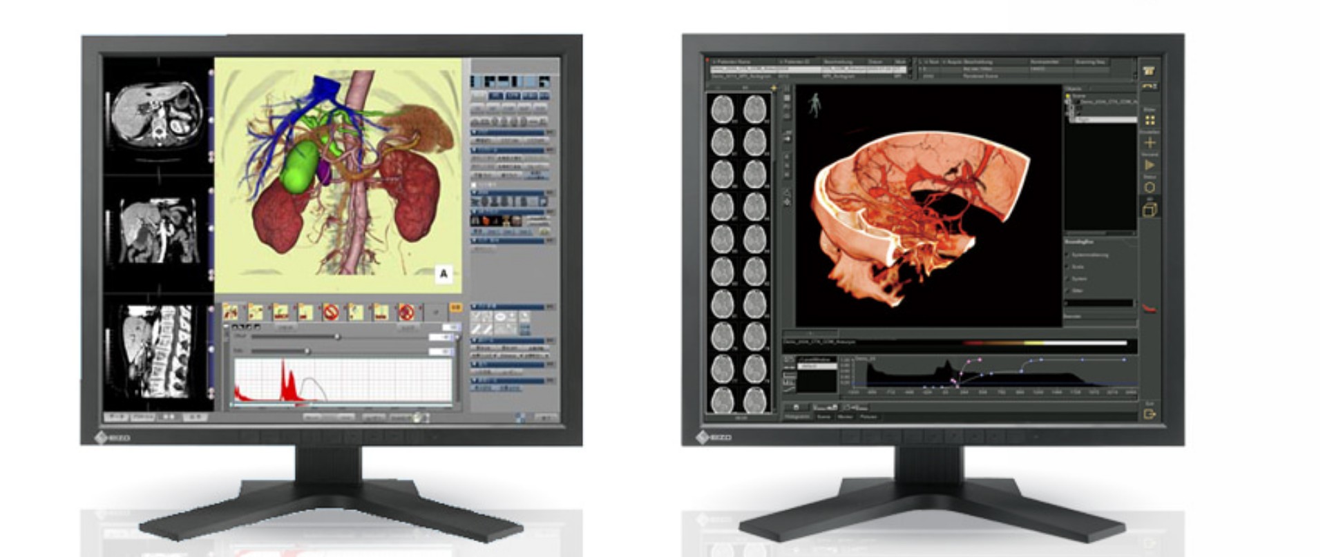 Eizo RadiForce RS110 COLOR LCD Medical MONITOR