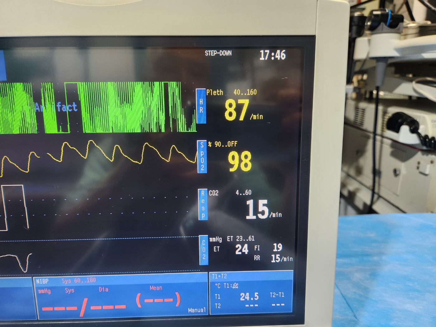 GE B40 Patient Monitor