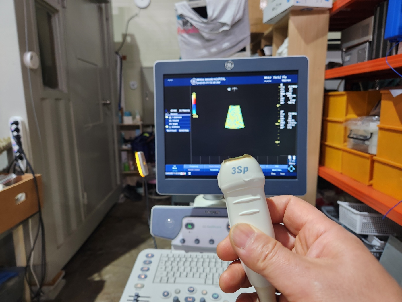 GE LOGIQ P6 Ultrasound System