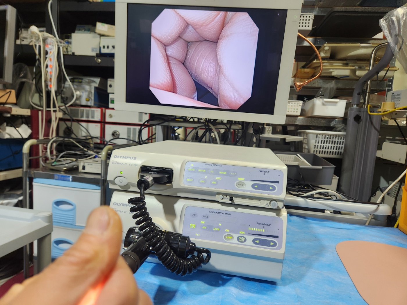 Olympus CV-180 HD Endoscopy System