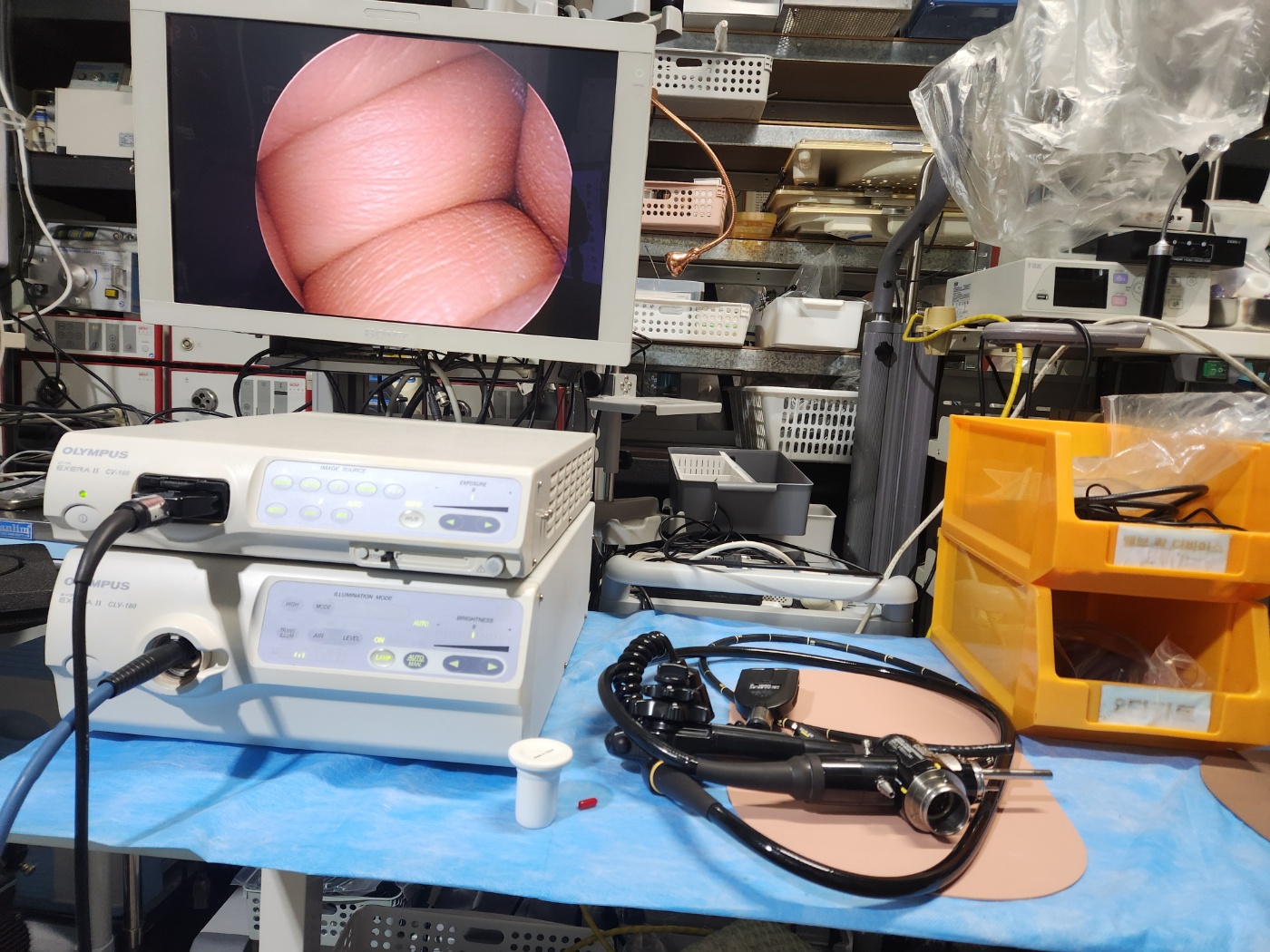 Olympus CV-180 HD Endoscopy System