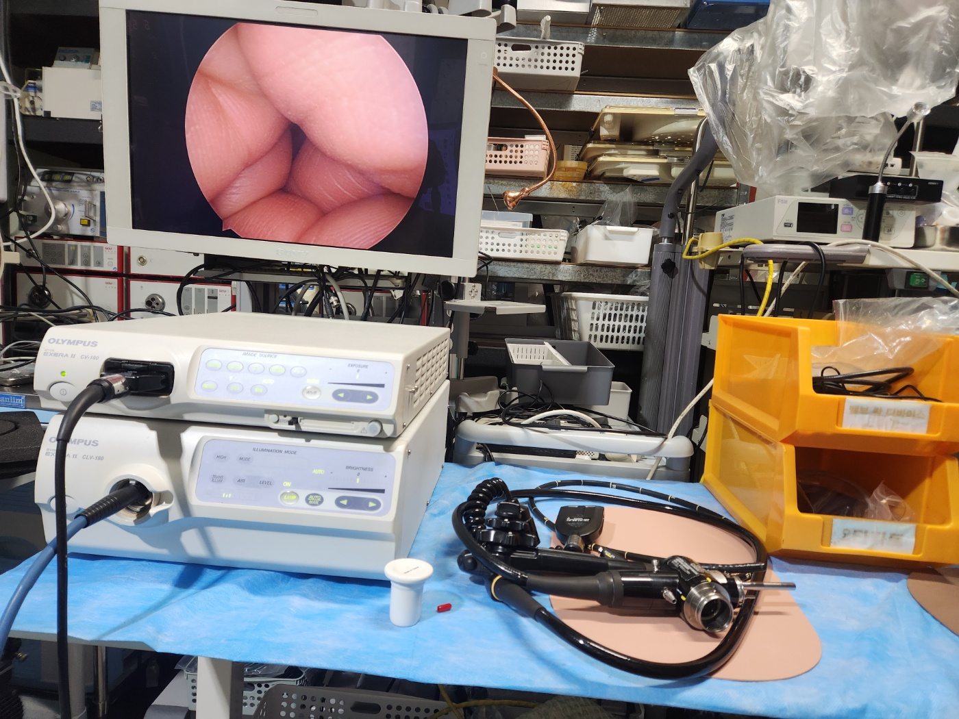 Olympus CV-180 HD Endoscopy System