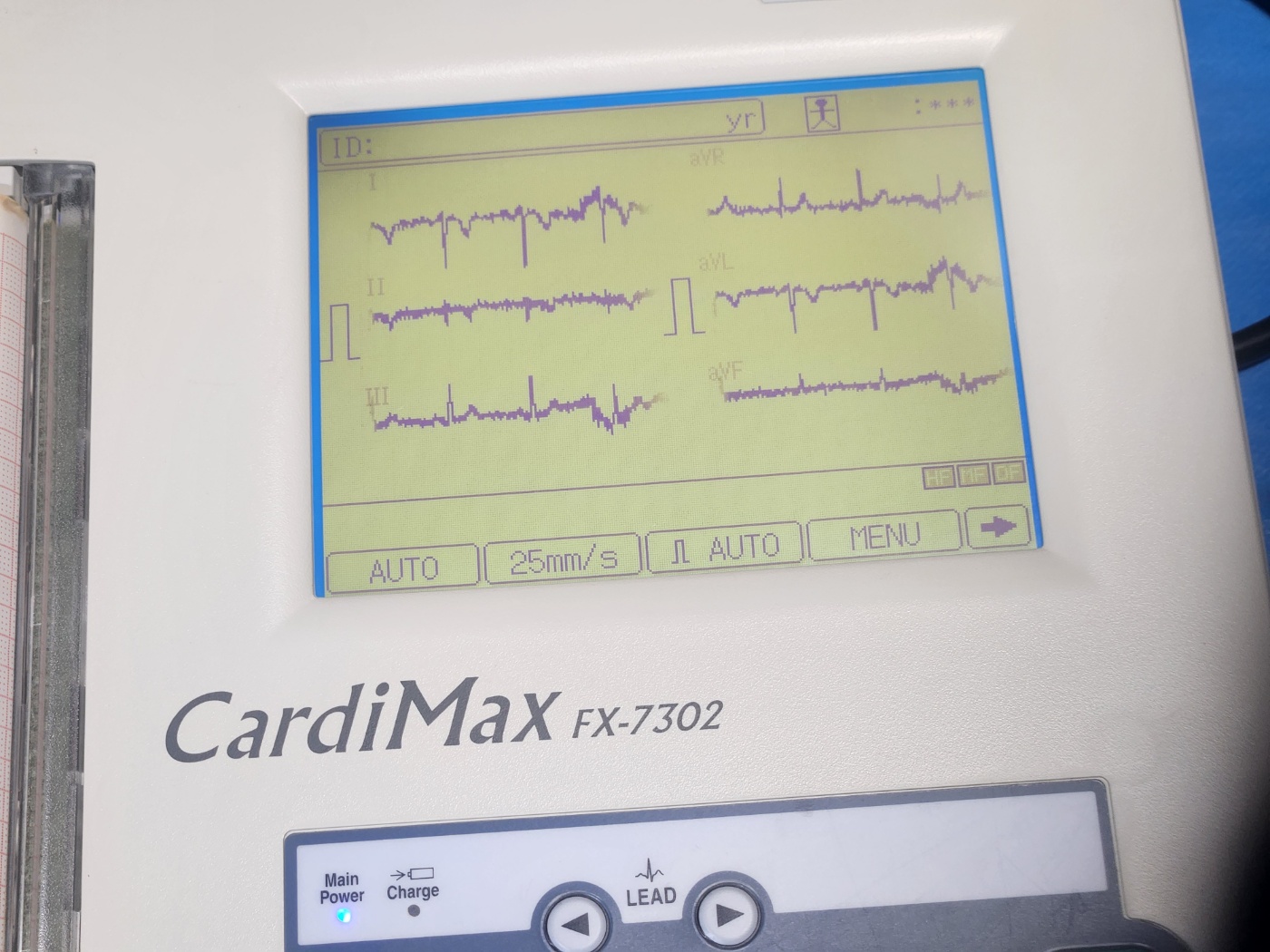 심전도검사기 CardiMax FX-7302