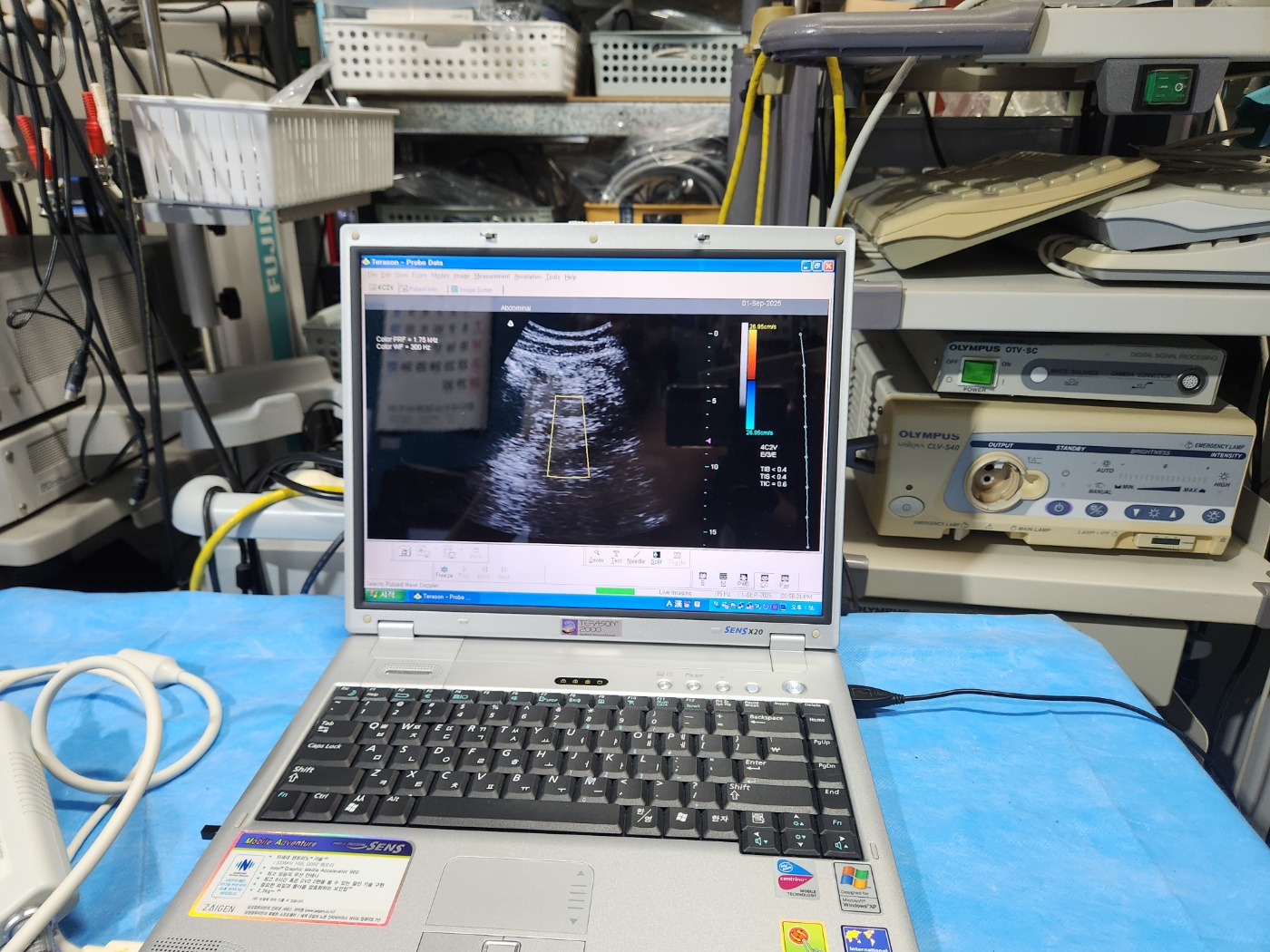 TERASON 2000 Handheld Ultrasound System
