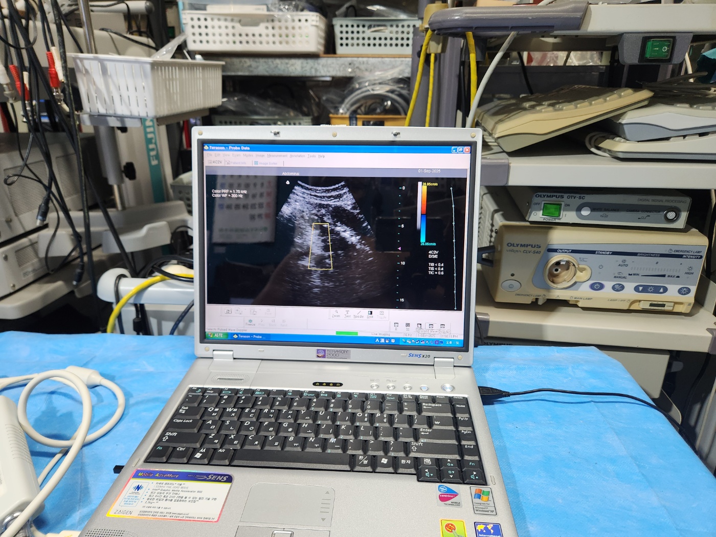 TERASON 2000 Handheld Ultrasound System