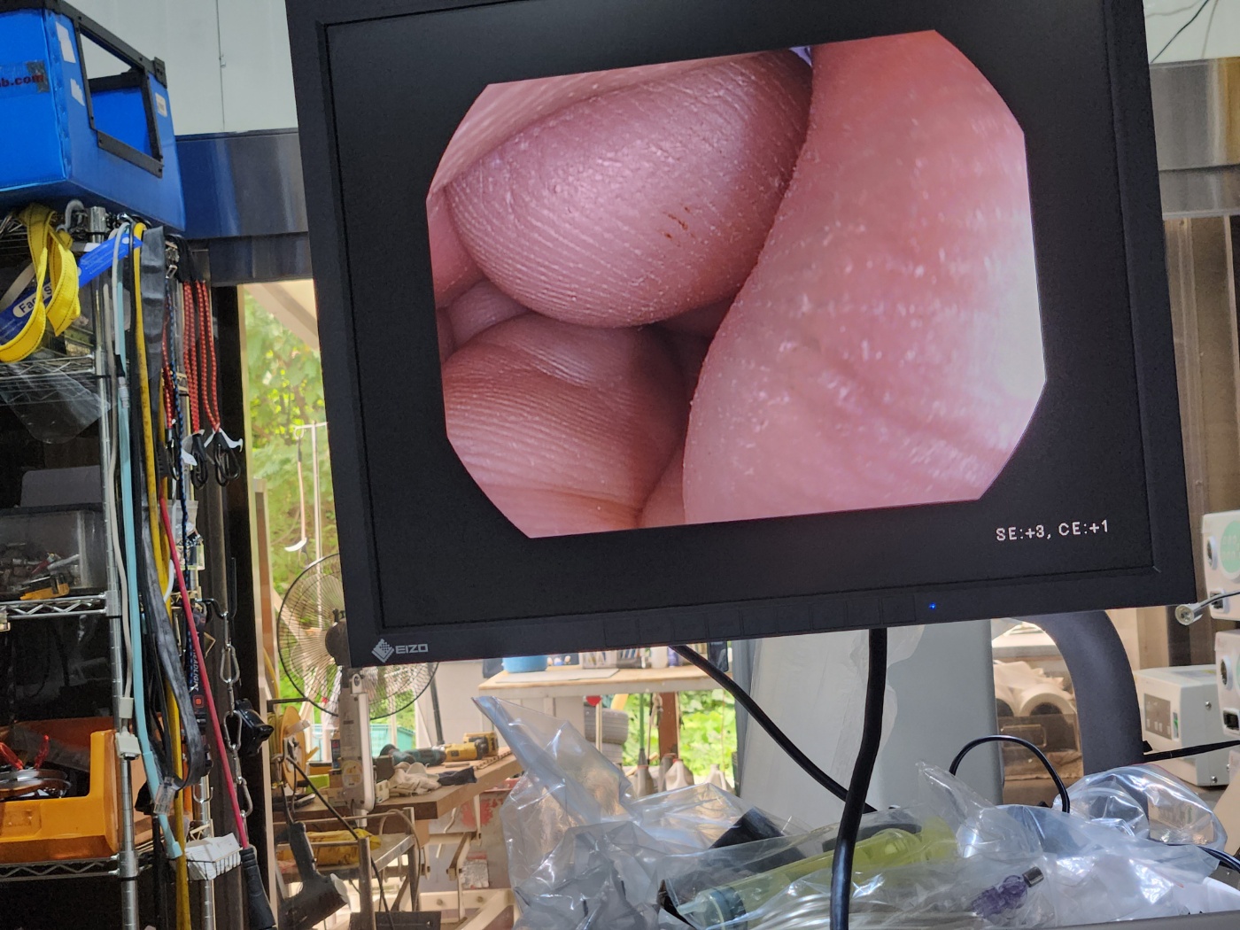 Pentax EG29-i10 HD Gastroscope