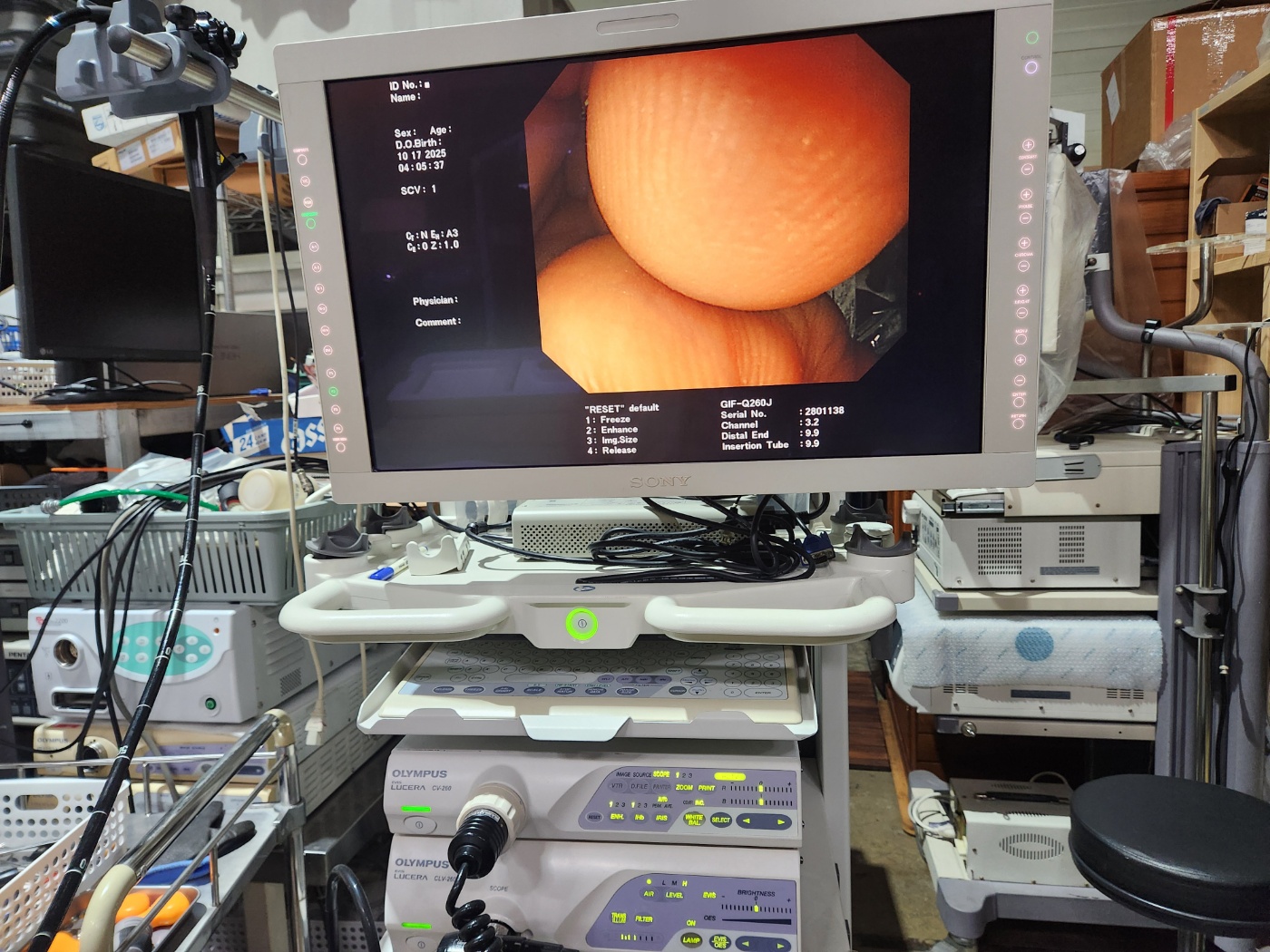 Olympus CV-260 HDTV Evis Lucera Endoscopy System