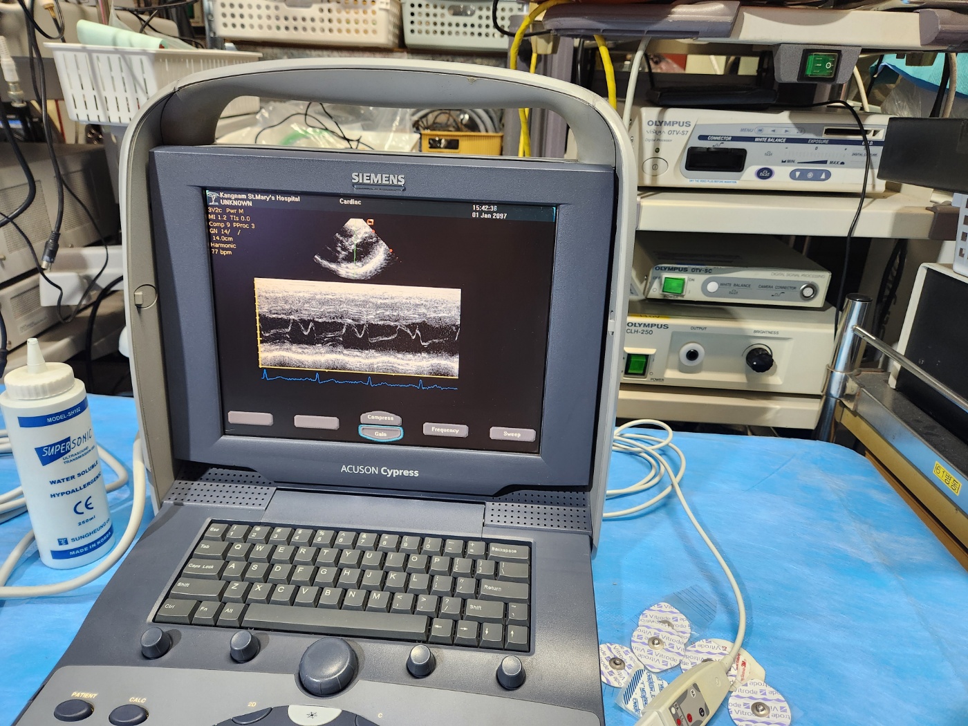 Siemens Acuson Cypress Ultrasound with 2 probes