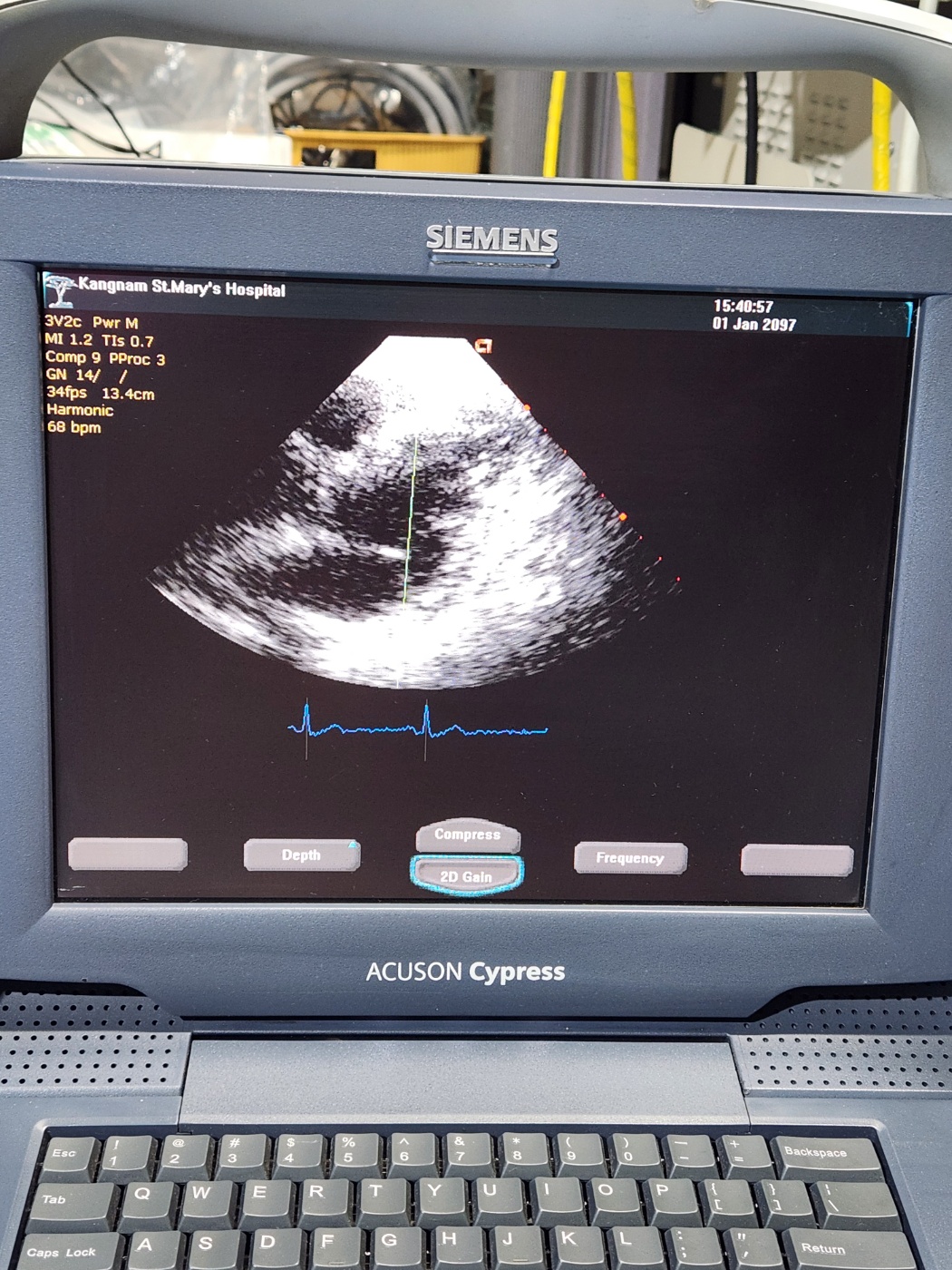 Siemens Acuson Cypress Ultrasound with 2 probes