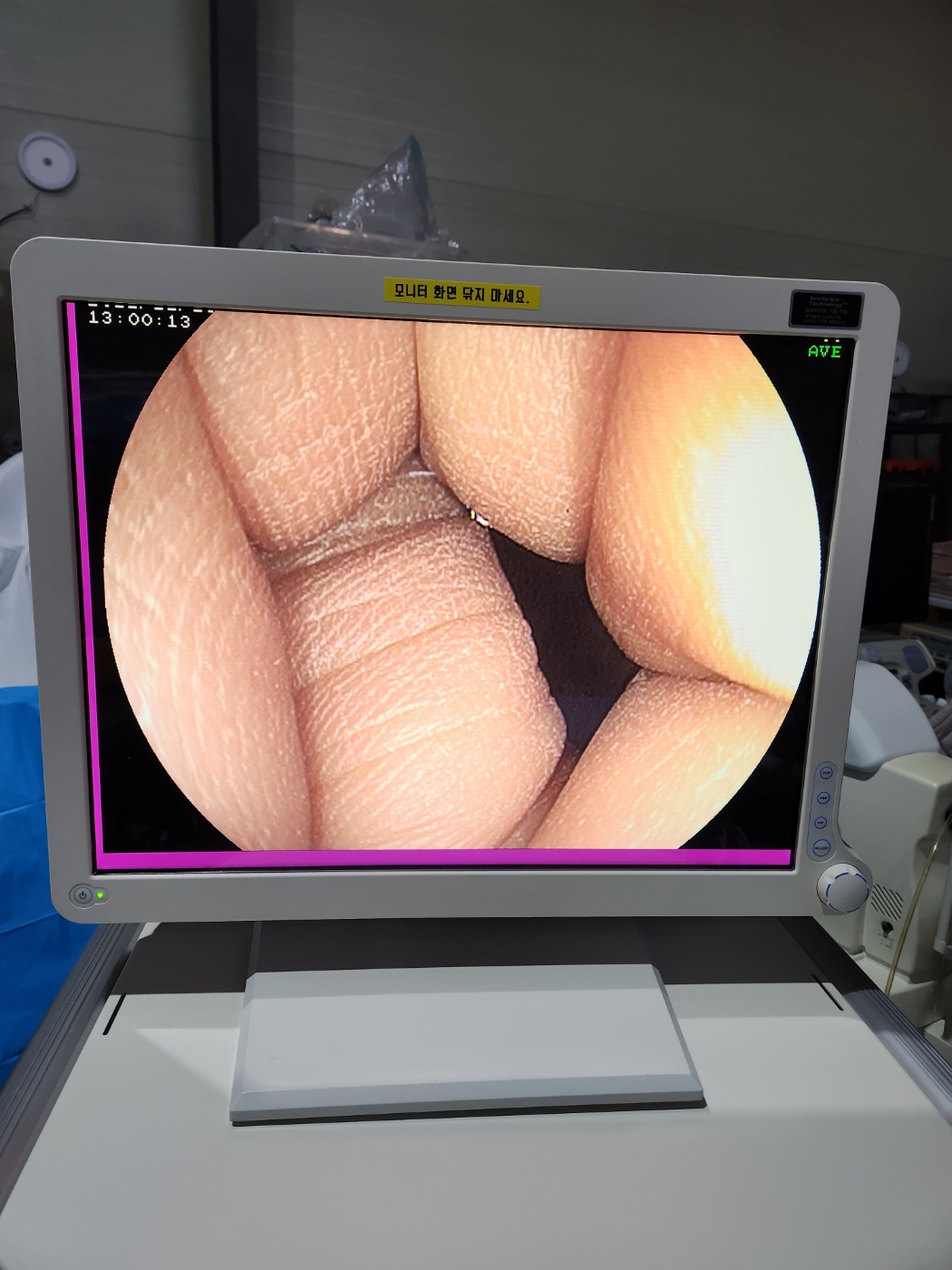 Fujinon EPX-2500 HD Complete Endoscopy System