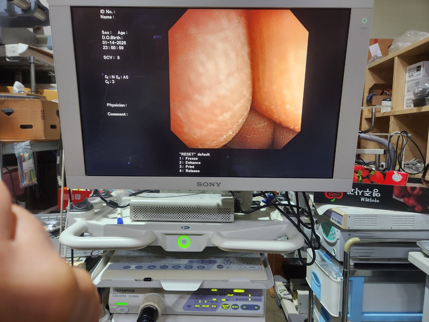 OLYMPUS GF-UM240  Ultrasound gastroscopes