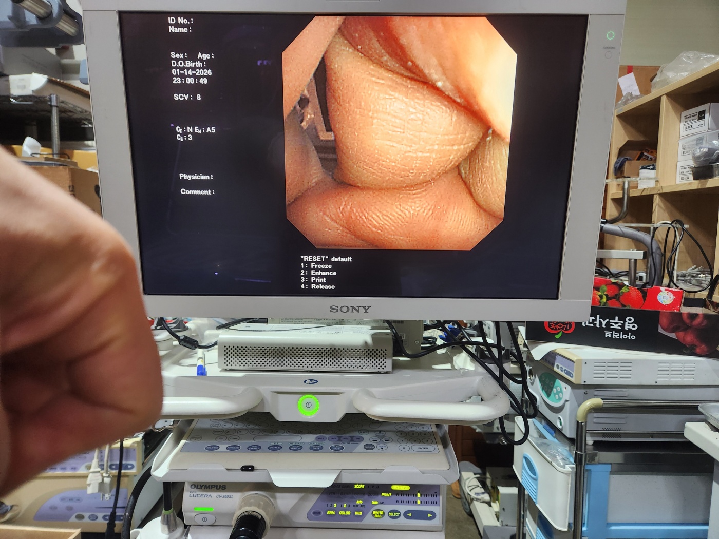 OLYMPUS GF-UM240  Ultrasound gastroscopes