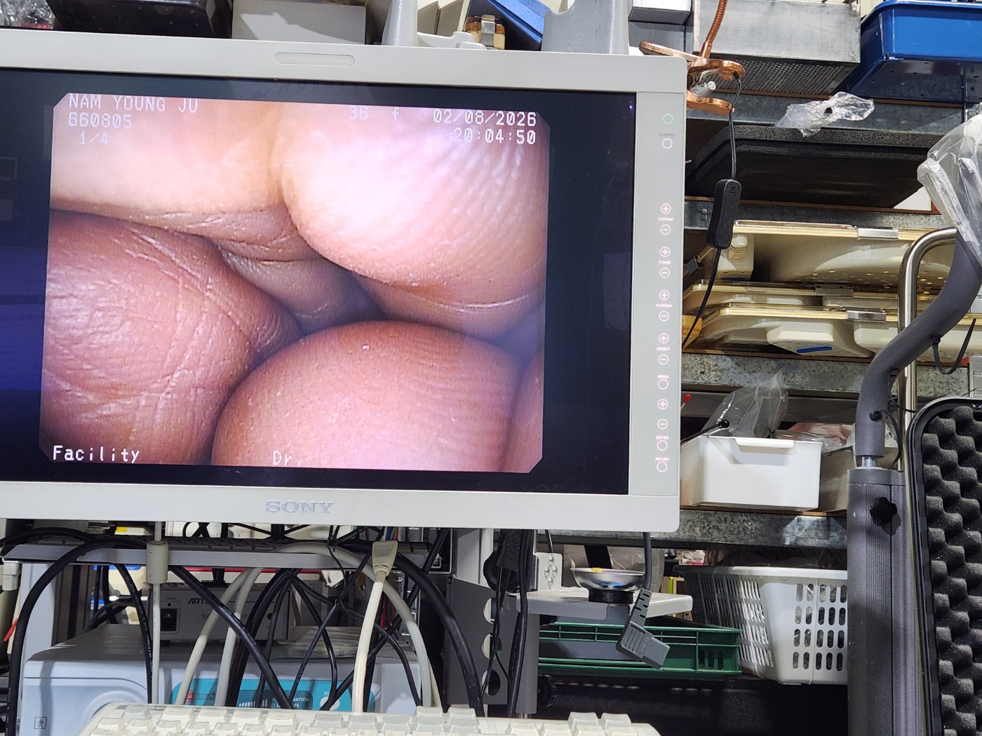 Pentax EG-290KP Gastroscope