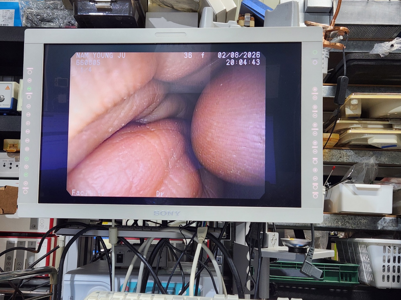 Pentax EG-290KP Gastroscope