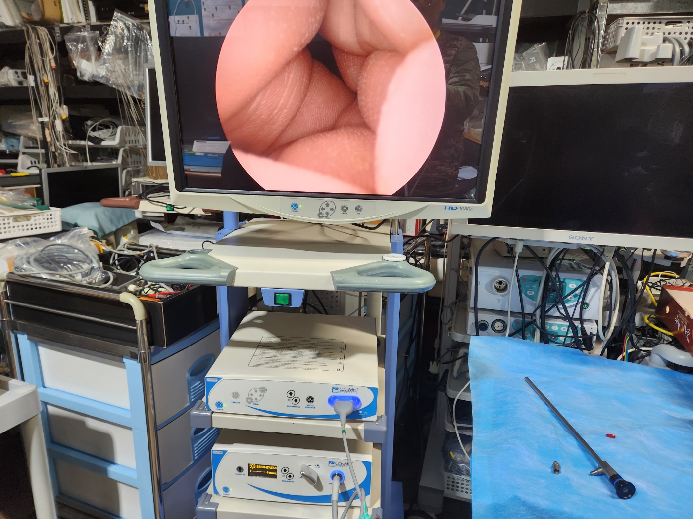 ConMed IM4000 HDTV Camera system