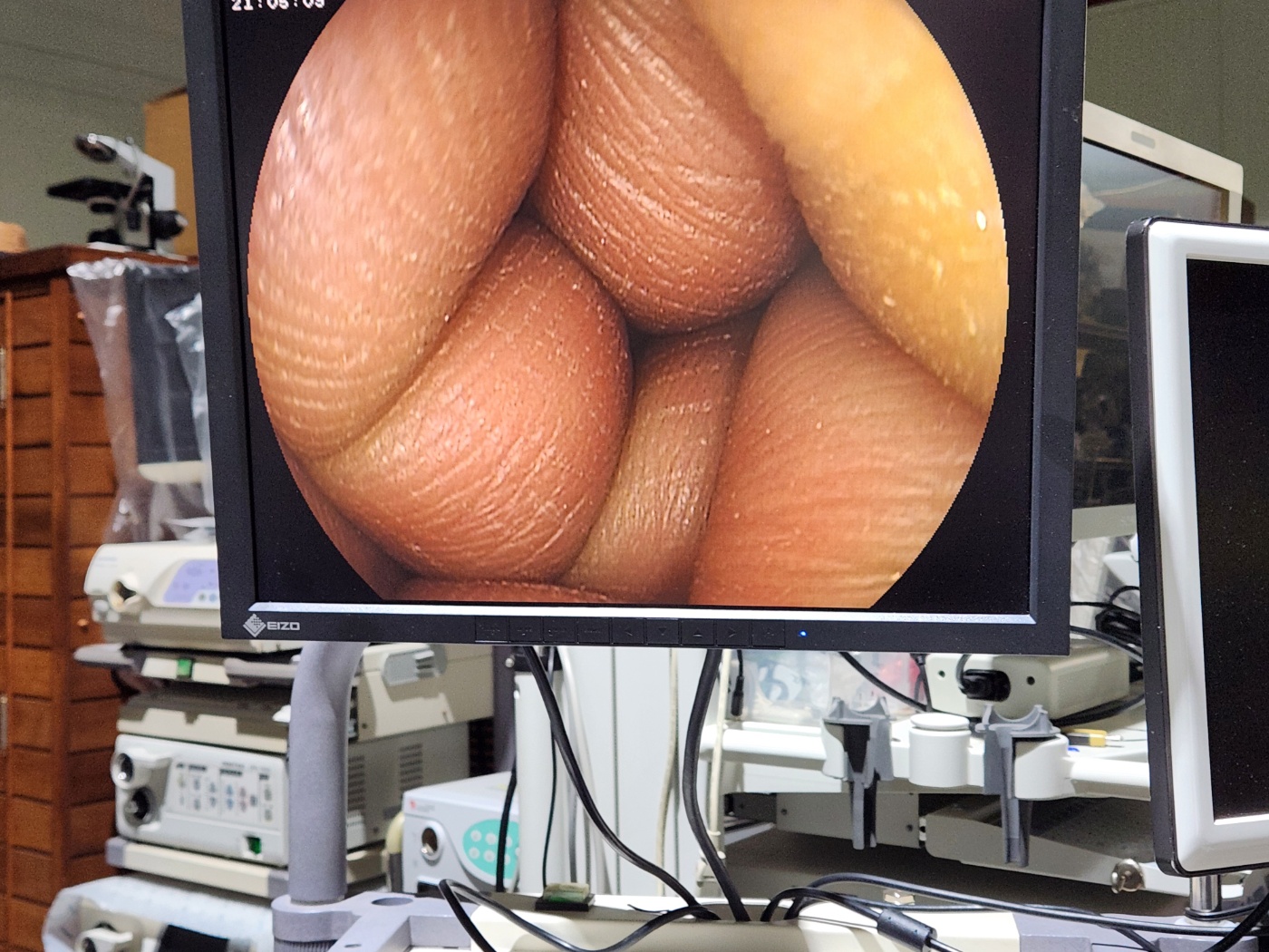 Fujinon EG-450WR5 Gastroscope