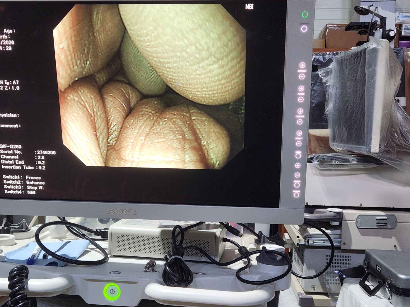 Olympus  CLV 260 NBI