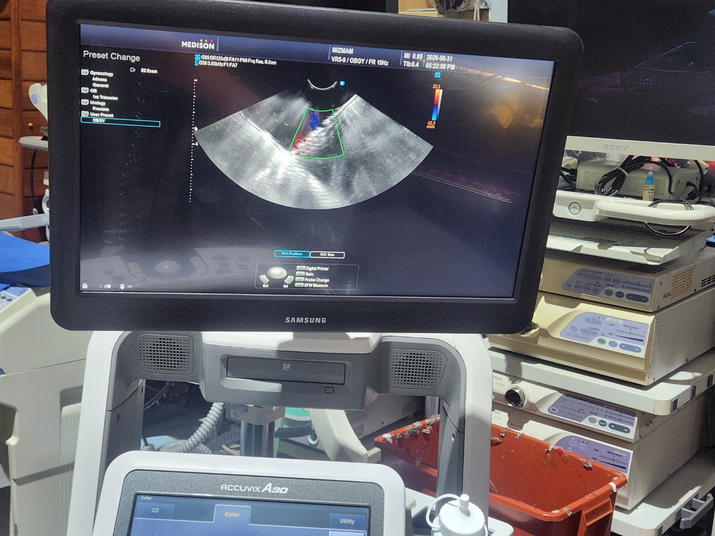 Samsung  Accuvix A30 ultrasound machine