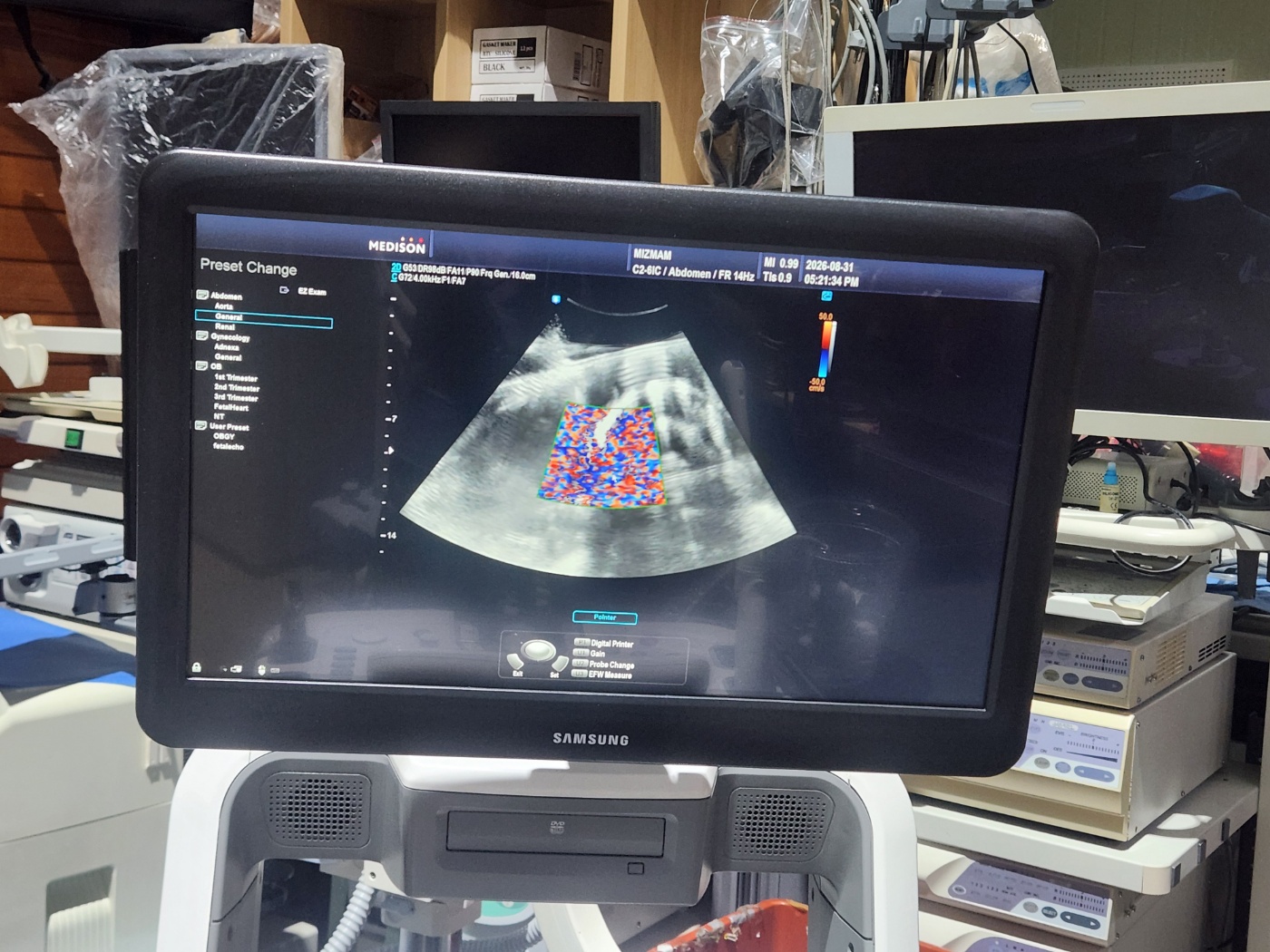 Samsung  Accuvix A30 ultrasound machine